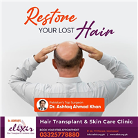 Restore Your Lost Hair Naturally at Elixir Hair Transplant Center Islamabad