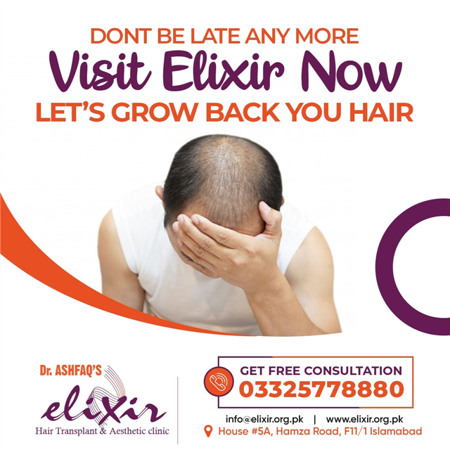 Grown Back Natural Hair Line by Dr. Ashfaq Khan at Elixir Hair Transplant Center Islamabad